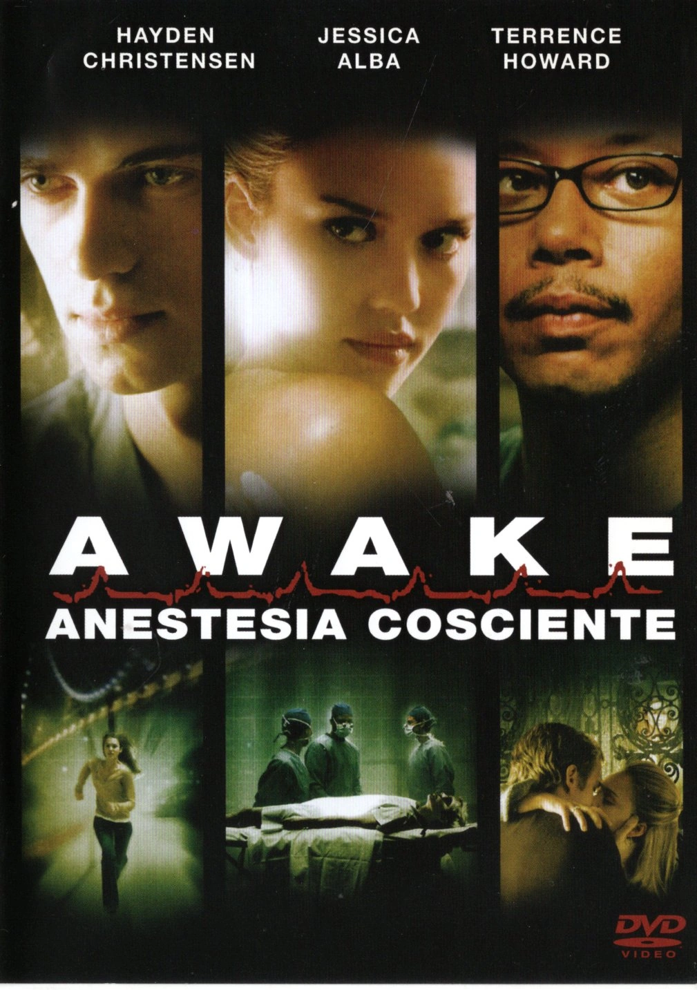 Awake - Anestesia cosciente